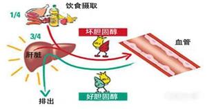 坏胆固醇与好胆固醇